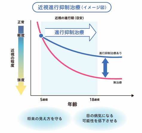 近視進行抑制治療