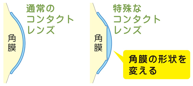 2014 170426号 コンタクトレンズ自動販売機 管理サーバ及びコンタクトレンズ自動販売機システム Astamuse